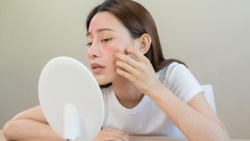 Can Benzoyl Peroxide Unclog Pores