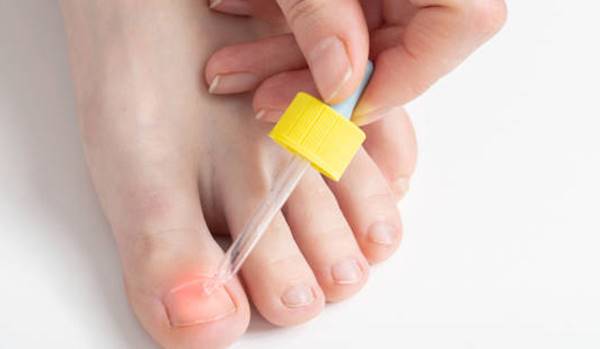 Treating White Spots on Toenails After Removing Polish