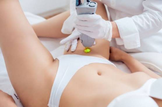 Side Effects of Laser Hair Removal On Bikini Area