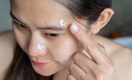 Using Benzoyl peroxide properly