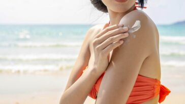 Using Sour Cream for Sunburn Relief